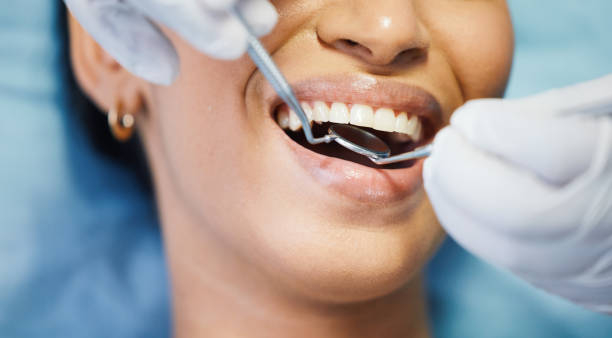 Best Urgent Care for Lost Fillings or Crowns in Boonville, IN